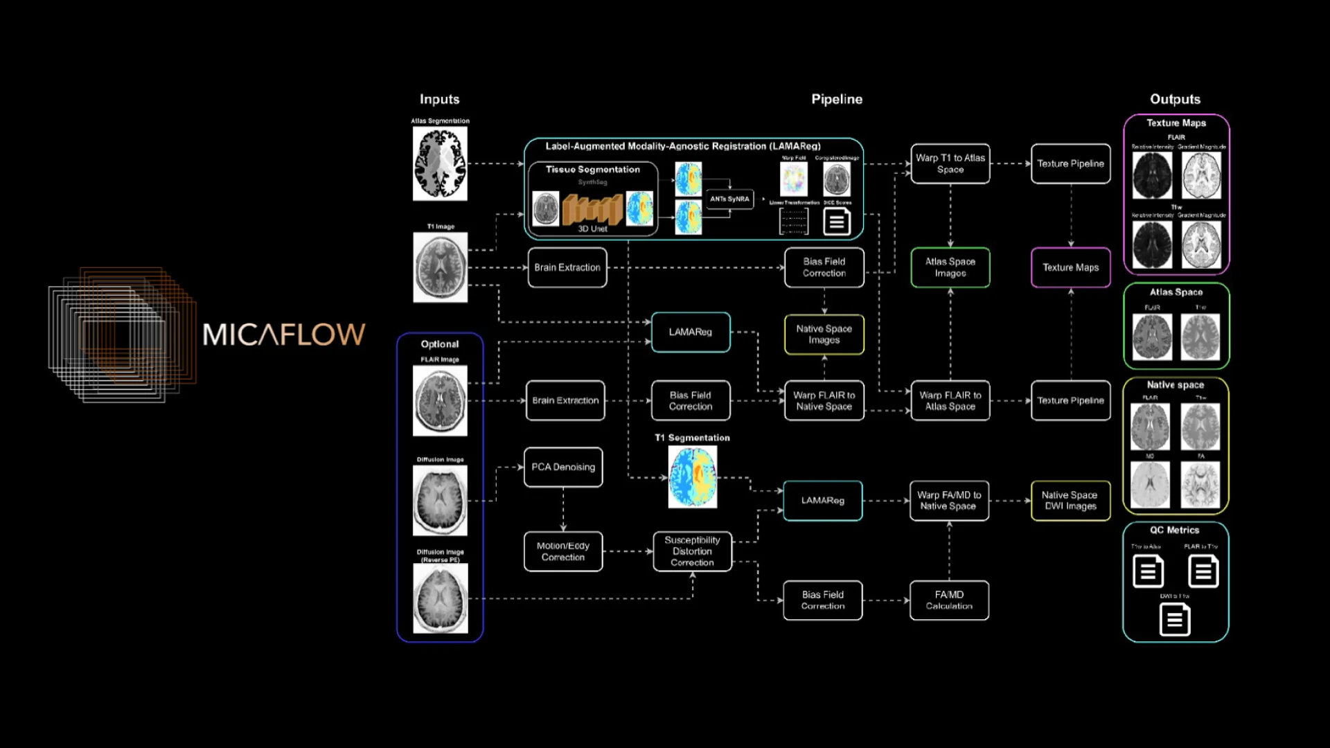 MRI processing pipeline