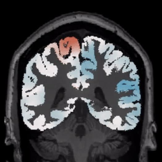 AI DIAGNOSTICS