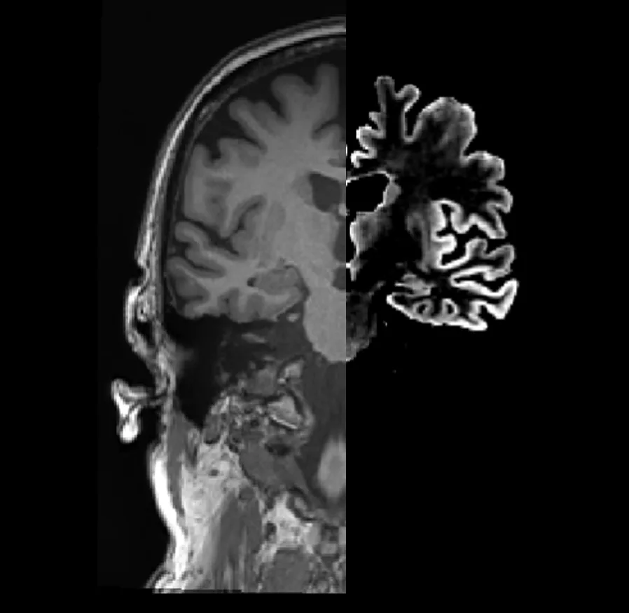 FUSED IMAGES